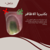 لقاء بكتيريا الأظافر