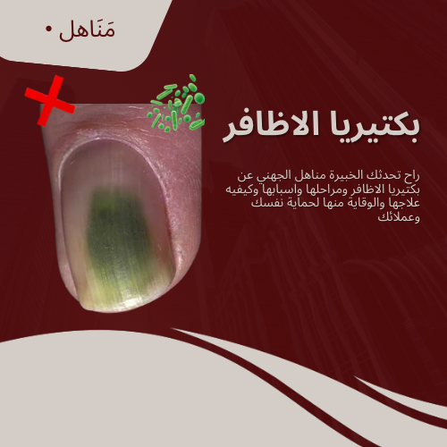 لقاء بكتيريا الأظافر